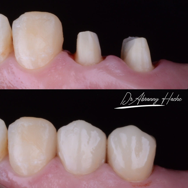 29ad9e4d-be8a-4f29-aca2-d8eb9c26130b 1