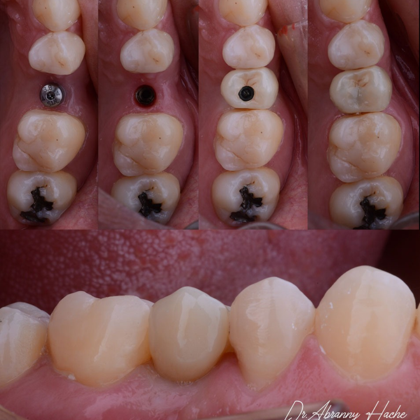 31a0baf8-6d12-4c06-9224-50aa3a12105e 1