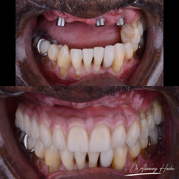 4379a00b-2994-48af-8a61-affa294dc88e 1