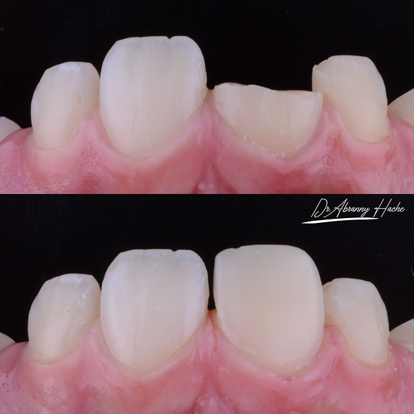 496645a6-9ee6-457b-99a2-80bfea9ea7d7 1