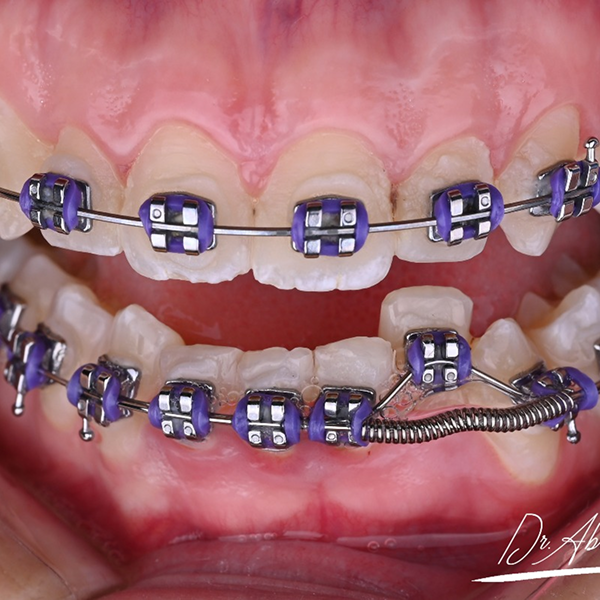 73272edf-8428-4943-b61d-7ce27b99ce63 1