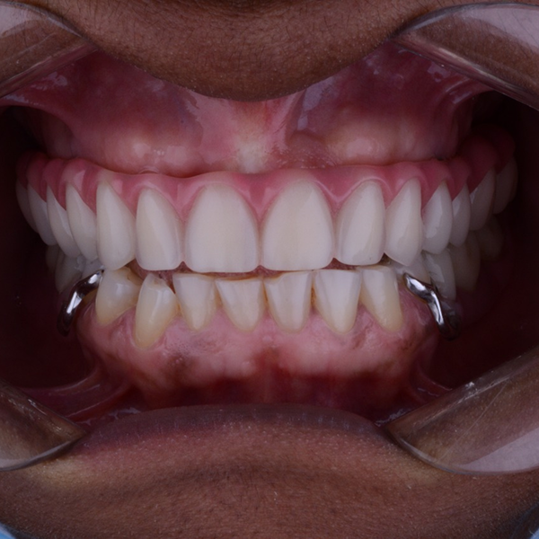 7770e93a-3714-4324-bb54-2cf46d43b028 1