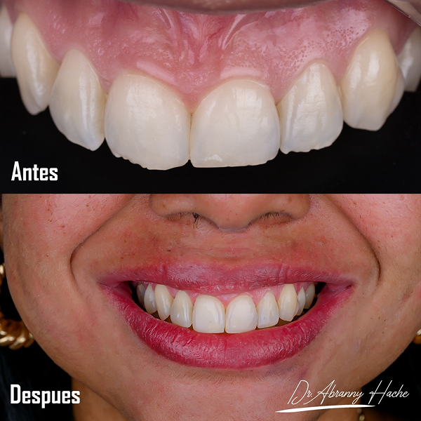 9cce5685-a2ed-49fb-8c53-65d06c00a77d 1