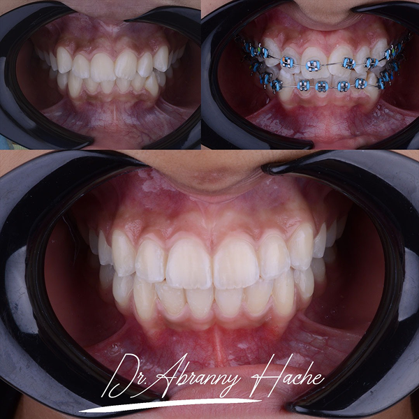 a0b4f495-1399-41b0-abe8-04c3767f7af1 1