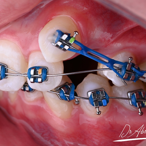 a0e48086-0cc3-4786-bcbc-ae298241a25a 1