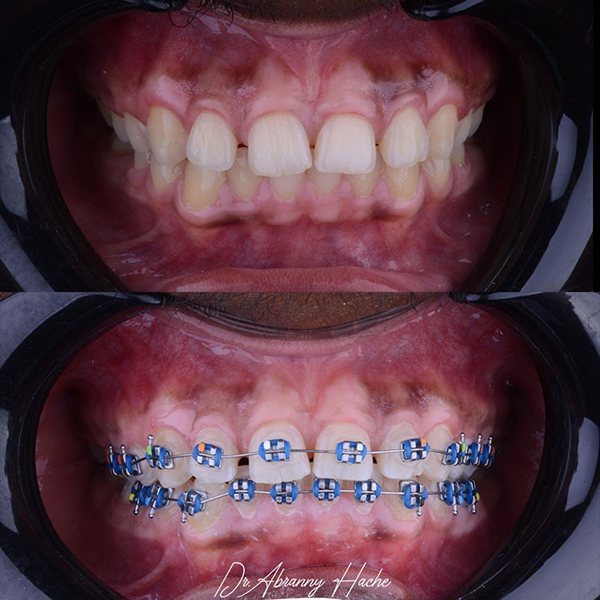 ab72e245-e9d1-403f-9dea-ce2dfdadd734 1