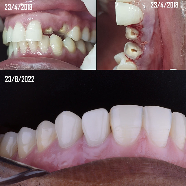 b94a8ae5-039e-465c-b46e-9d6fbd88c7a4 1