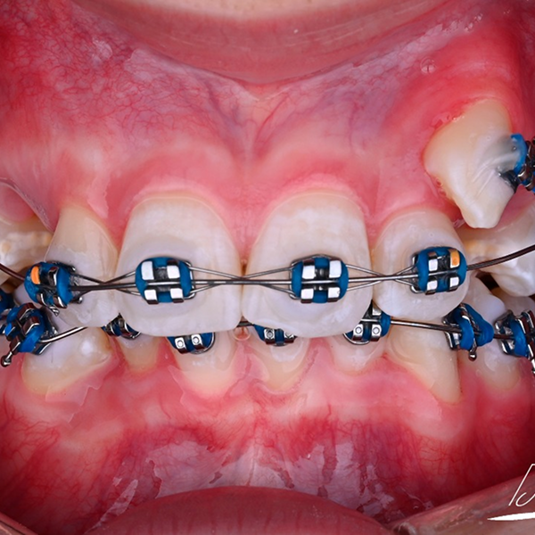 cced55bd-aaf3-4ef6-924b-7d06ac9090e7 1